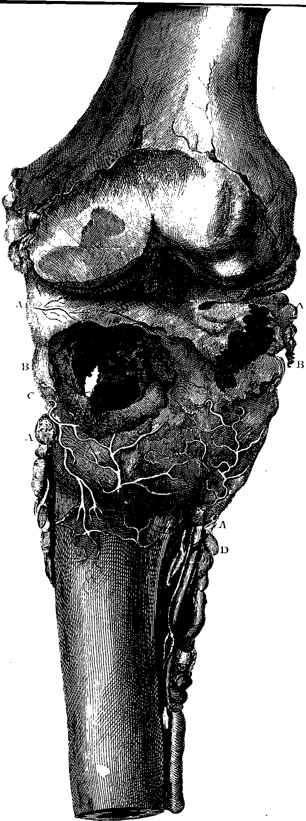 Eine Schwarz-Weiß-Zeichnung eines menschlichen Knies mit einem Bruch in der Mitte und Text unten mit der Aufschrift "Anatomie des Kniegelenks".